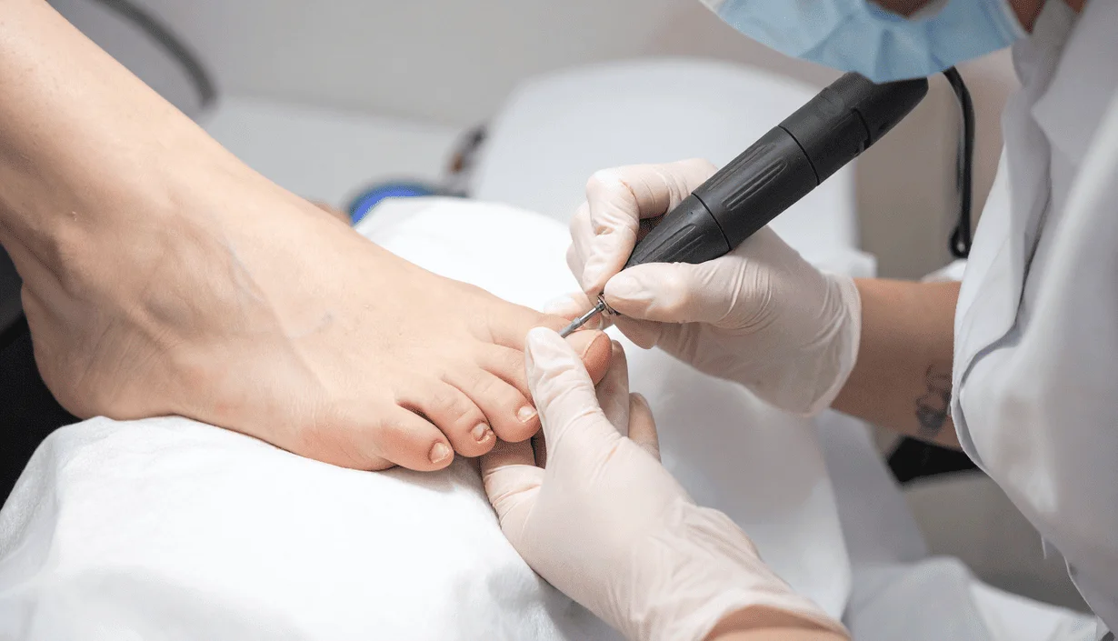 medical-pedicure-service-kassandra-nails-thessaloniki